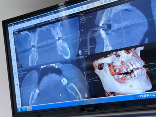 3D画像モニター