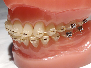 ④ 飯田橋で矯正治療ができます