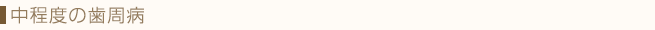 中程度の歯周病