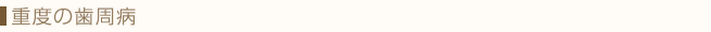 重度の歯周病