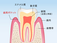 歯周ポケットについて