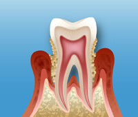自分自身でする歯磨きとの違い