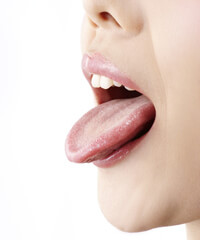 舌苔（ぜったい）が原因のタイプ