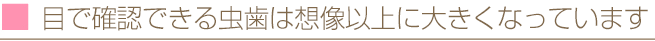 目で確認できる虫歯は想像以上に大きくなっています