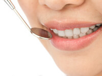 2.インプラント治療の前処置