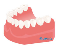 7.インプラント治療後のメンテナンス