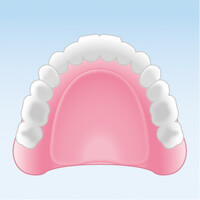 保険の入れ歯（レジン義歯）